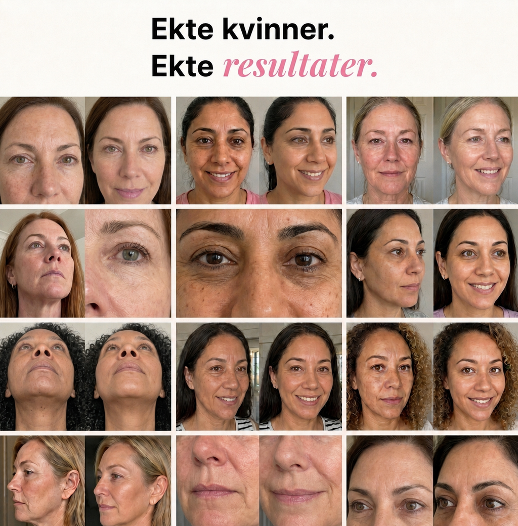 Kollagen Volume Balm – For fine linjer og strålende hud
