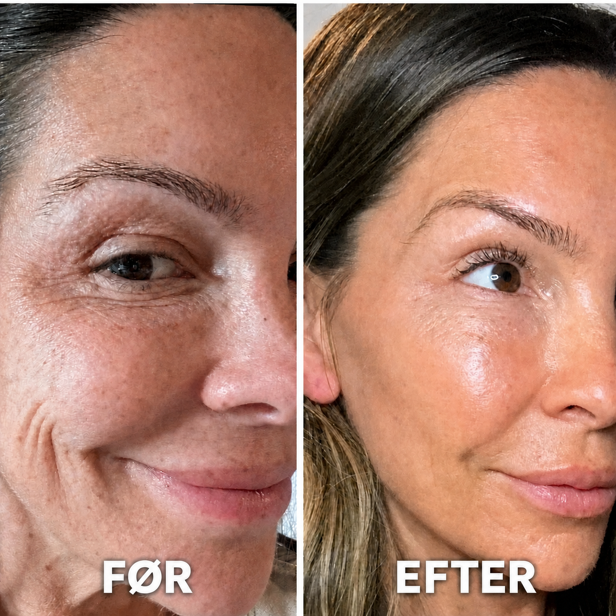 Kollagen Volume Balm – Til Fine Linjer & Strålende Hud