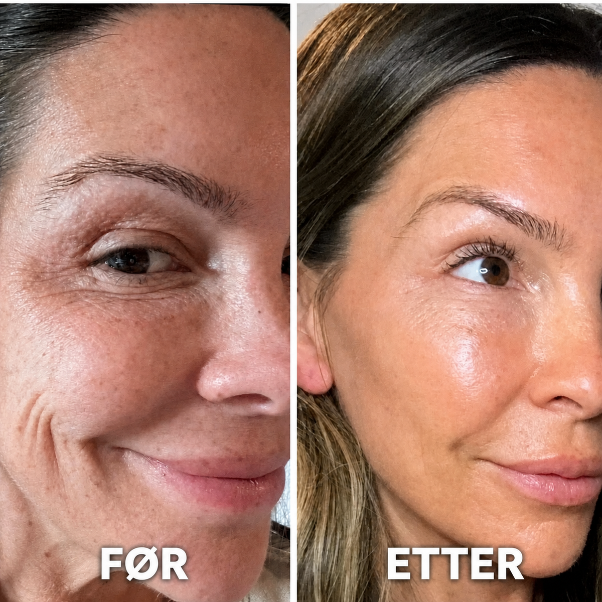 Kollagen Volume Balm – For fine linjer og strålende hud